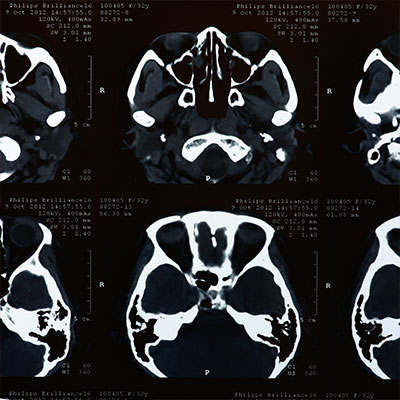 Development of Mid-level Form Vision